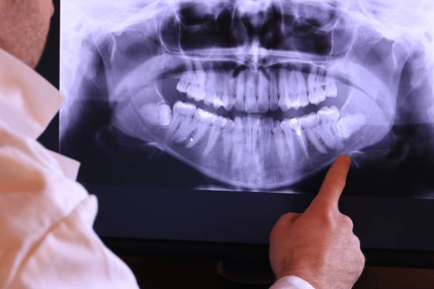 Best Emergency Tooth Extraction in Conrad, IA